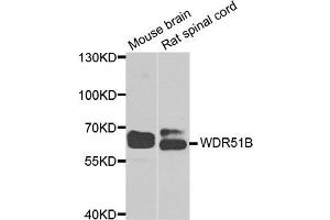 Western blot analysis of extracts of mouse brain and rat spinal cord  cell lines, using WDR51B( POC1B ) antibody. (POC1B antibody)