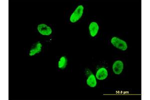 Immunofluorescence of monoclonal antibody to RNF168 on HepG2 cell. (RNF168 antibody  (AA 462-571))