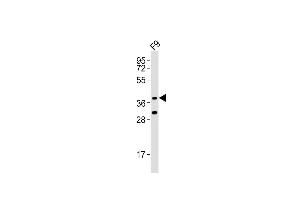 Anti-Rnf2 Antibody (Center) at 1:1000 dilution + F9 whole cell lysates Lysates/proteins at 20 μg per lane. (RNF2 antibody  (AA 165-199))