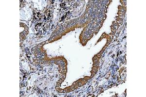 IHC analysis of VAPA using anti-VAPA antibody (ABIN7603249). (VAPA antibody  (N-Term))