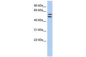 Image no. 1 for anti-Zinc Finger Protein 513 (ZNF513) (AA 467-516) antibody (ABIN6740630) (ZNF513 antibody  (AA 467-516))