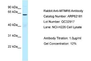 Western Blotting (WB) image for anti-Myotubularin Related Protein 6 (MTMR6) (C-Term) antibody (ABIN2789053) (MTMR6 antibody  (C-Term))