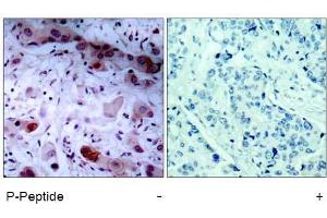 Image no. 1 for anti-Janus Kinase 1 (JAK1) (pTyr1022) antibody (ABIN196869) (JAK1 antibody  (pTyr1022))