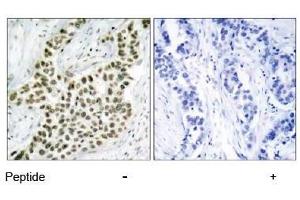 Image no. 3 for anti-H2A Histone Family, Member X (H2AFX) (Ser139) antibody (ABIN197524) (H2AFX antibody  (Ser139))