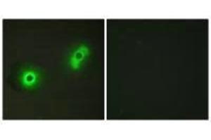 Immunofluorescence analysis of A549 cells, using Ik3-2 antibody. (CABLES2 antibody)