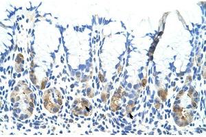 Human Stomach; Rabbit Anti-ADAT1 Antibody. (ADAT1 antibody  (C-Term))
