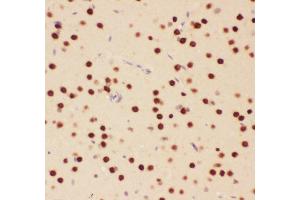 Anti-ATF2 Picoband antibody,  IHC(P): Rat Brain Tissue (ATF2 antibody  (AA 93-450))