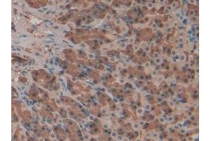 Detection of Hpt in Rat Stomach Tissue using Polyclonal Antibody to Haptoglobin (Hpt) (Haptoglobin antibody  (AA 104-346))