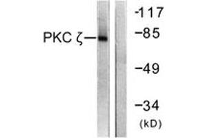 Western blot analysis of extracts from COS7 cells, treated with PMA 125ng/ml 30', using PKC zeta (Ab-560) Antibody. (PKC zeta antibody  (AA 526-575))