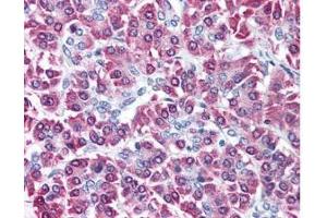 Immunohistochemistry (IHC) image for anti-Cbl proto-oncogene C (CBLC) (C-Term) antibody (ABIN129659)