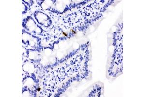 IHC testing of FFPE rat intestine with PYY antibody. (Peptide YY antibody  (AA 29-64))