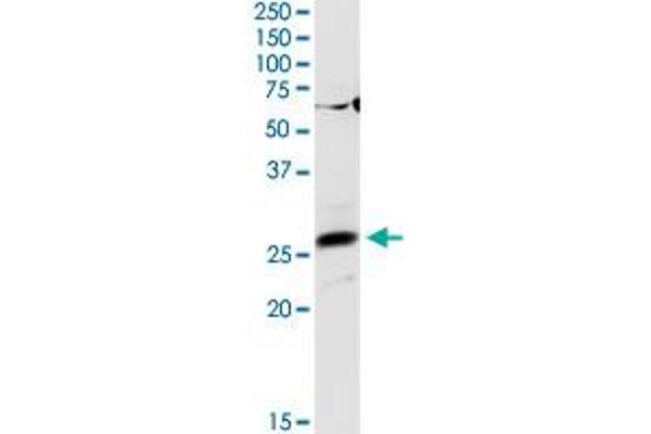 AGPAT2 antibody  (AA 1-278)