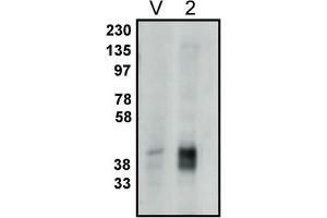 Image no. 1 for anti-Phosphatidic Acid Phosphatase Type 2C (PPAP2C) antibody (ABIN398285) (PPAP2C antibody)
