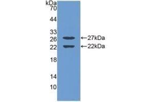 Detection of Recombinant EGR1, Mouse using Polyclonal Antibody to Early Growth Response Protein 1 (EGR1) (EGR1 antibody  (AA 273-431))