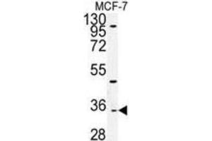 Western Blotting (WB) image for anti-Tocopherol (Alpha) Transfer Protein-Like (TTPAL) antibody (ABIN3002253) (TTPAL antibody)