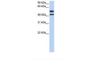 Image no. 1 for anti-Glucosamine (N-Acetyl)-6-Sulfatase (GNS) (AA 398-447) antibody (ABIN6738147) (GNS antibody  (AA 398-447))
