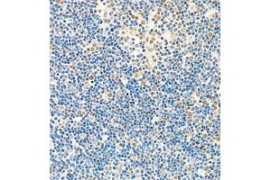 Immunohistochemistry of paraffin embedded rat thymus using Skar (ABIN7074970) at dilution of 1:1800 (400x lens) (p46 antibody)