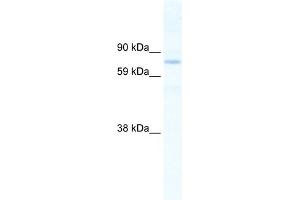 WB Suggested Anti-SIN3B Antibody Titration:  2. (SIN3B antibody  (N-Term))