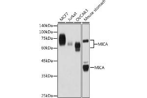 Western blot analysis of extracts of various cell lines, using MICA antibody (ABIN7268508) at 1:1000 dilution. (MICA antibody)