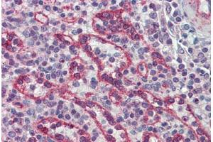 Human Spleen: Formalin-Fixed, Paraffin-Embedded (FFPE) (IRAK2 antibody  (AA 111-210))