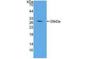 Detection of Recombinant PSMD10, Human using Polyclonal Antibody to Proteasome 26S Subunit, Non ATPase 10 (PSMD10) (PSMD10 antibody  (AA 1-226))