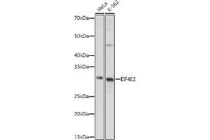Western blot analysis of extracts of various cell lines, using EIF4E2 antibody (ABIN6130366, ABIN6140086, ABIN6140087 and ABIN6220578) at 1:1000 dilution. (EIF4E2 antibody  (AA 1-240))