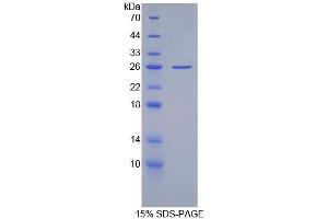 SDS-PAGE (SDS) image for Apoprotein B100 (Apo-B100) (AA 3365-3548) protein (His tag) (ABIN1877789)