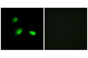 Immunofluorescence analysis of A549 cells, using HSPB2 antibody. (HSPB2 antibody  (C-Term))