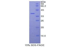SDS-PAGE (SDS) image for Fibulin 4 (FBLN4) (AA 278-366) protein (His tag,GST tag) (ABIN2122868)