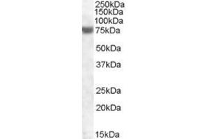 Western Blotting (WB) image for anti-Fem-1 Homolog A (FEM1A) (AA 656-669) antibody (ABIN490527) (FEM1A antibody  (AA 656-669))