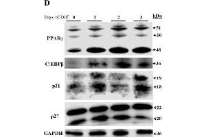 Expression of Dnmt3a spliced variants in adipose tissues and during the time-course analysis of preadipocyte differentiation. (PPARG antibody  (AA 101-200))