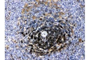 Immunohistochemistry (IHC) image for anti-Lactate Dehydrogenase B (LDHB) (AA 237-334) antibody (ABIN4886658)