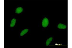 Immunofluorescence of purified MaxPab antibody to SPOP on HeLa cell. (SPOP-B antibody  (AA 1-374))