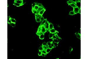 Figure:FITC staining on IHC-P Simple: Mcf7 cells (Hexokinase 2 antibody  (AA 619-917))