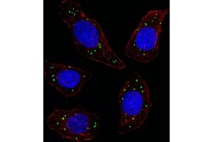 Fluorescent image of U251 cell stained with MERTK Antibody. (MERTK antibody)