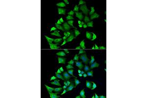 Immunofluorescence analysis of A549 cells using ENTPD2 antibody.