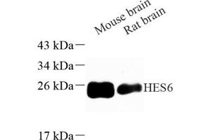 Western blot analysis of HES6 (ABIN7074161) at dilution of 1: 500 (HES6 antibody)