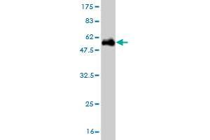 Western Blot detection against Immunogen (54. (UROS antibody  (AA 1-265))