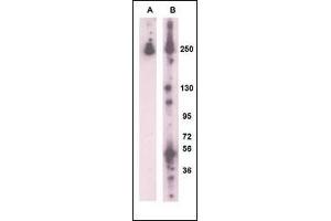 Western blot analysis of RK8 (LRRK2) (arrow) using rabbit polyclonal RK8 (LRRK2)Antibody  g. (LRRK2 antibody  (AA 931-962))
