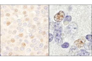 Immunohistochemistry (IHC) image for anti-DEAD (Asp-Glu-Ala-Asp) Box Polypeptide 46 (DDX46) (C-Term) antibody (ABIN7453688)