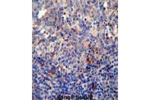 Immunohistochemistry (IHC) image for anti-B-Cell CLL/lymphoma 10 (BCL10) antibody (ABIN2995789) (BCL10 antibody)