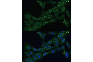 Immunofluorescence analysis of C6 cells using ETFB Polyclonal Antibody (ABIN7266916) at dilution of 1:100 (40x lens). (ETFB antibody  (AA 80-230))