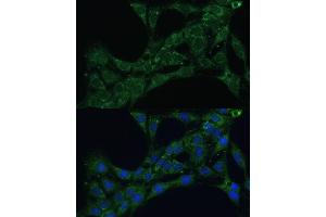 Immunofluorescence analysis of C6 cells using ETFB Polyclonal Antibody (ABIN7266916) at dilution of 1:100 (40x lens).