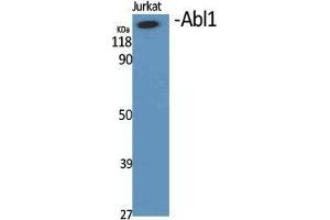 Western Blotting (WB) image for anti-C-Abl Oncogene 1, Non-Receptor tyrosine Kinase (ABL1) (Ser12) antibody (ABIN6281133)