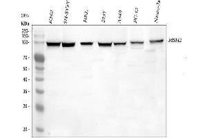 Western blot analysis of MSH2 using anti-MSH2 antibody (ABIN3043885).