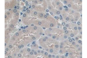DAB staining on IHC-P; Samples: Mouse Kidney Tissue (PICK1 antibody  (AA 24-229))