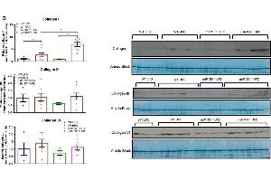 miR155 deletion increases adipose tissue fibrosis under high-fat diet (HFD) conditions in male mice. (COL3 antibody  (AA 1301-1400))