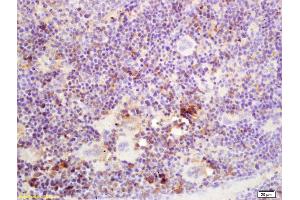 Formalin-fixed and paraffin embedded mouse spleen labeled with Rabbit Anti SSA/52KDa Ro3 Polyclonal Antibody, Unconjugated (ABIN671196) at 1:200 followed by conjugation to the secondary antibody and DAB staining (TRIM21 antibody  (AA 301-400))