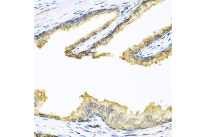 Immunohistochemistry (IHC) image for anti-Proenkephalin (PENK) (AA 25-267) antibody (ABIN6145444)