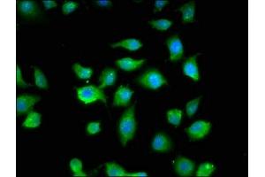 Immunofluorescence staining of A549 cells with ABIN7160609 at 1:200, counter-stained with DAPI.